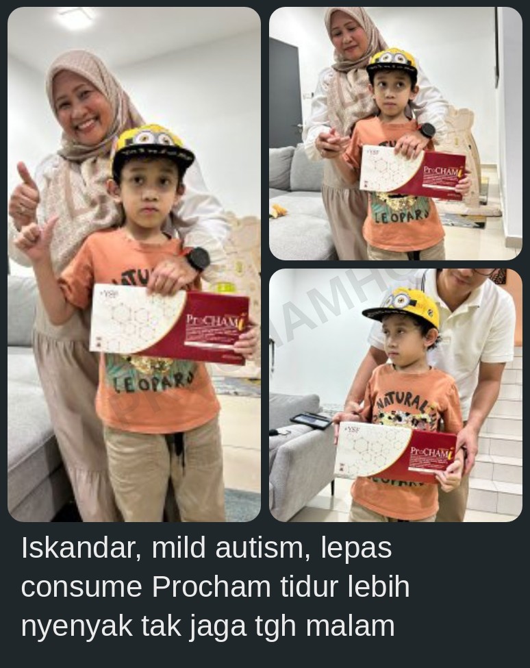 Testimoni Iskandar, mild autism, tidur lebih nyenyak selepas Procham